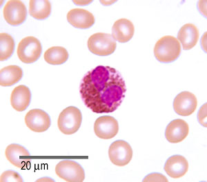 photo of an eosinophil