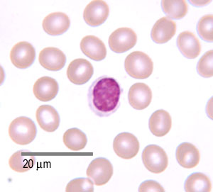 photo of a lymphocyte