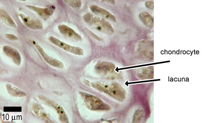 photo of hyaline cartilage