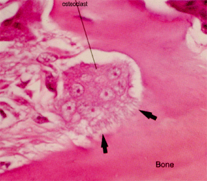 photo of osteoclast