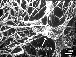 photo of osteocyte (SEM)