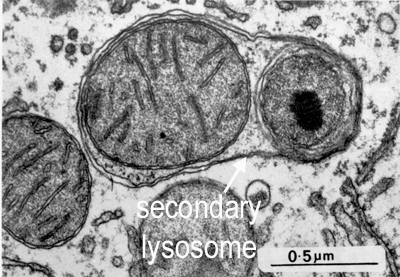 EM of secondary lysosome