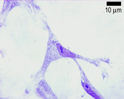 photo of a fibroblast