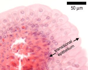 photo of transitional epithelium