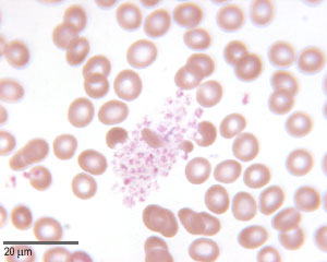 platelets photo