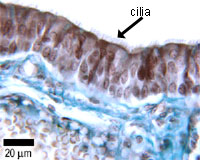 photo of ciliated cells