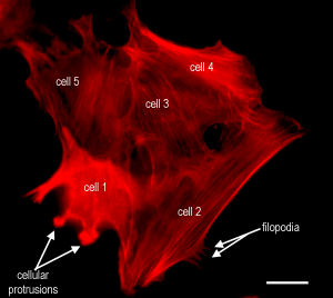 photo cells stained for actin