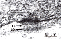 electron micrograph showing a Hemidesmosome