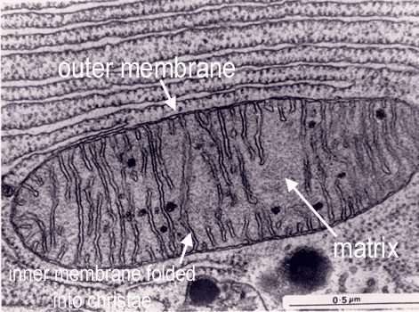 picture of mitochondrion (EM)