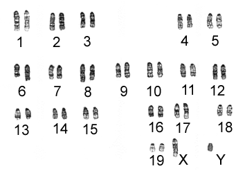 karyotype picture
