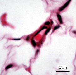 photo of capillary