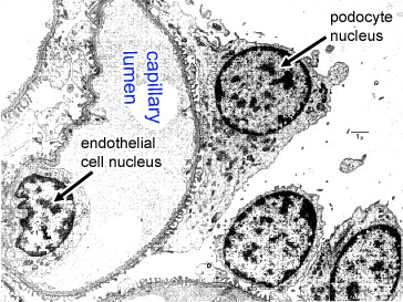 photo (EM) of fenestrated capillary