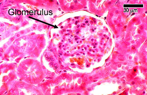 photo of glomerulus