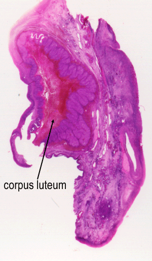 micrograph of corpus luteum in a human ovary