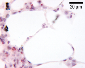 photo of alveoli