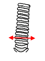 diagram of trachea