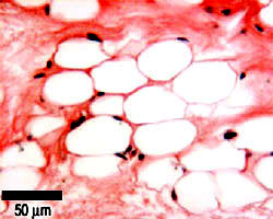 picture of adipocytes
