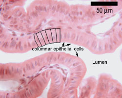 photo of columnar epithelium
