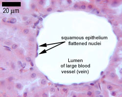 Simple squamous epithelium