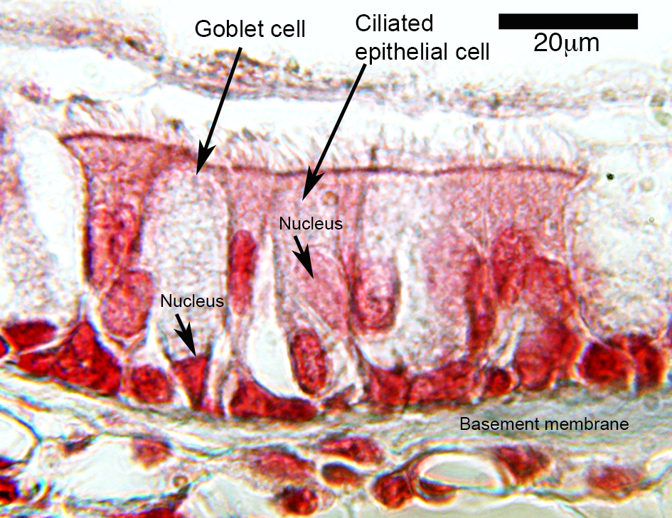 image of the epithelium of the trachea