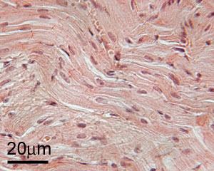 photo of cardiac muscle