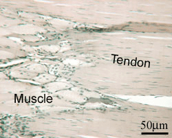photo of muscle with tendon