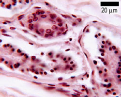 photo of duct and myoepithelial cells