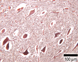 photo of neurons Nissl stain