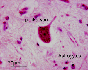 photo of H&E stained CNS