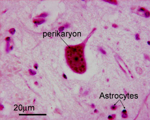 photograph of cell body in CNS