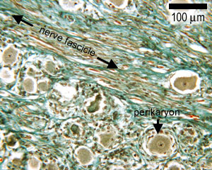 photo of massons trichrome staining