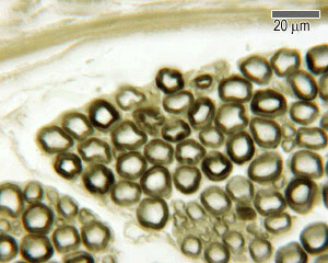 photo of osmium staining