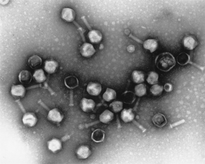 picture of a bacteriophage